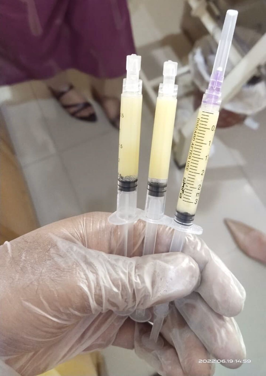 Artgel Bio Filler Machine – Advanced PRP Gel & Bio Filler Preparation System